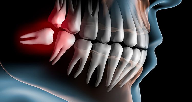 © psdesign1 - Fotolia.com